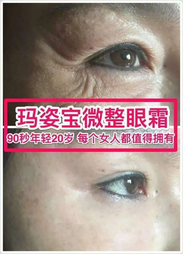 玛姿宝90秒国际微整眼霜真的那么好用吗？安全吗？怎么做代理？