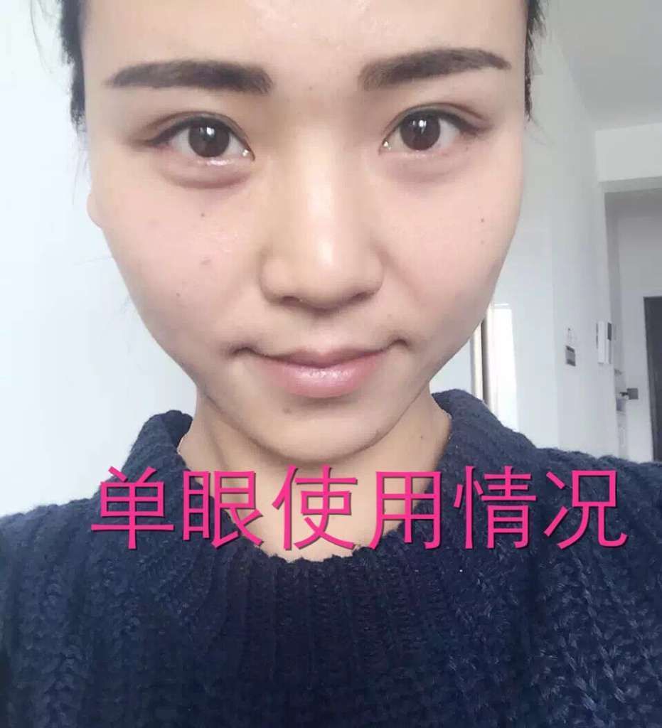 玛姿宝90秒国际微整眼霜真的那么好用吗？安全吗？怎么做代理？