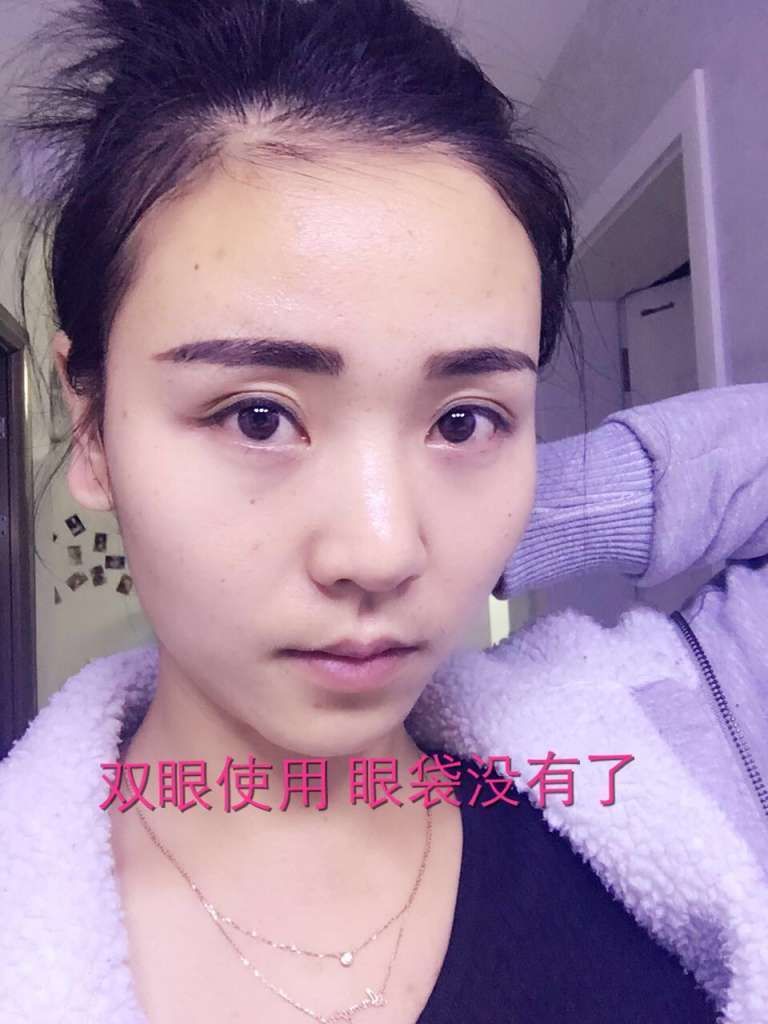 玛姿宝90秒国际微整眼霜真的那么好用吗？安全吗？怎么做代理？